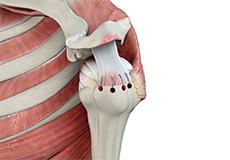 Rotator Cuff Pain